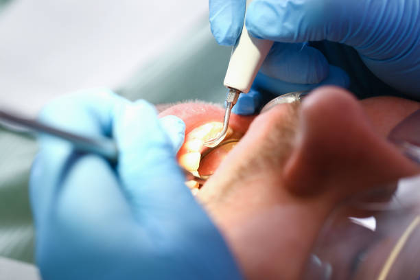 Best Emergency Care for Gum Disease in Canadian, TX