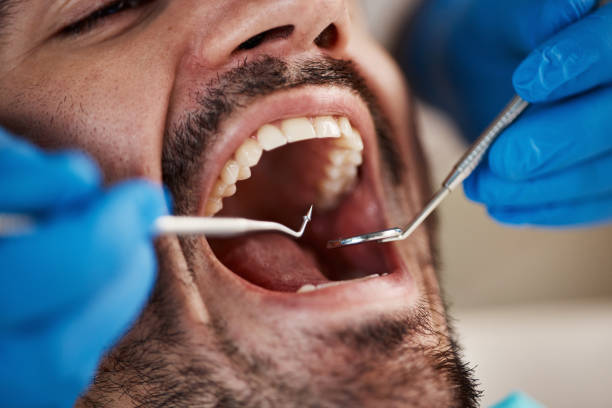 Best Walk-In Emergency Dental Services in Canadian, TX